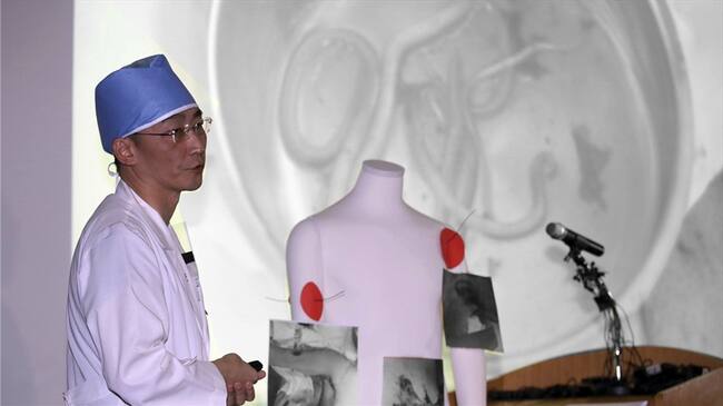Detectan enormes parásitos en soldado que huyó de Norcorea. Foto: Associated Press - AP