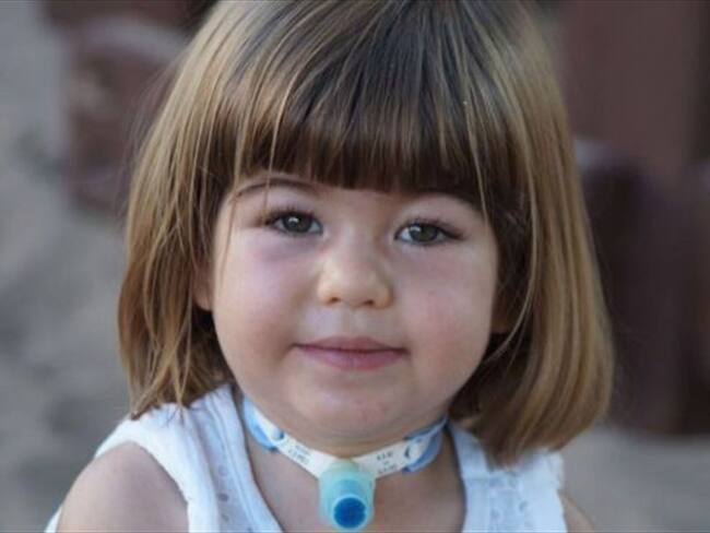 El síndrome de Ondina cancela las reacciones automáticas del cuerpo, lo que hace que muchos pacientes no puedan respirar mientras duermen. Foto: JOSÉ BRU / BBC Mundo.