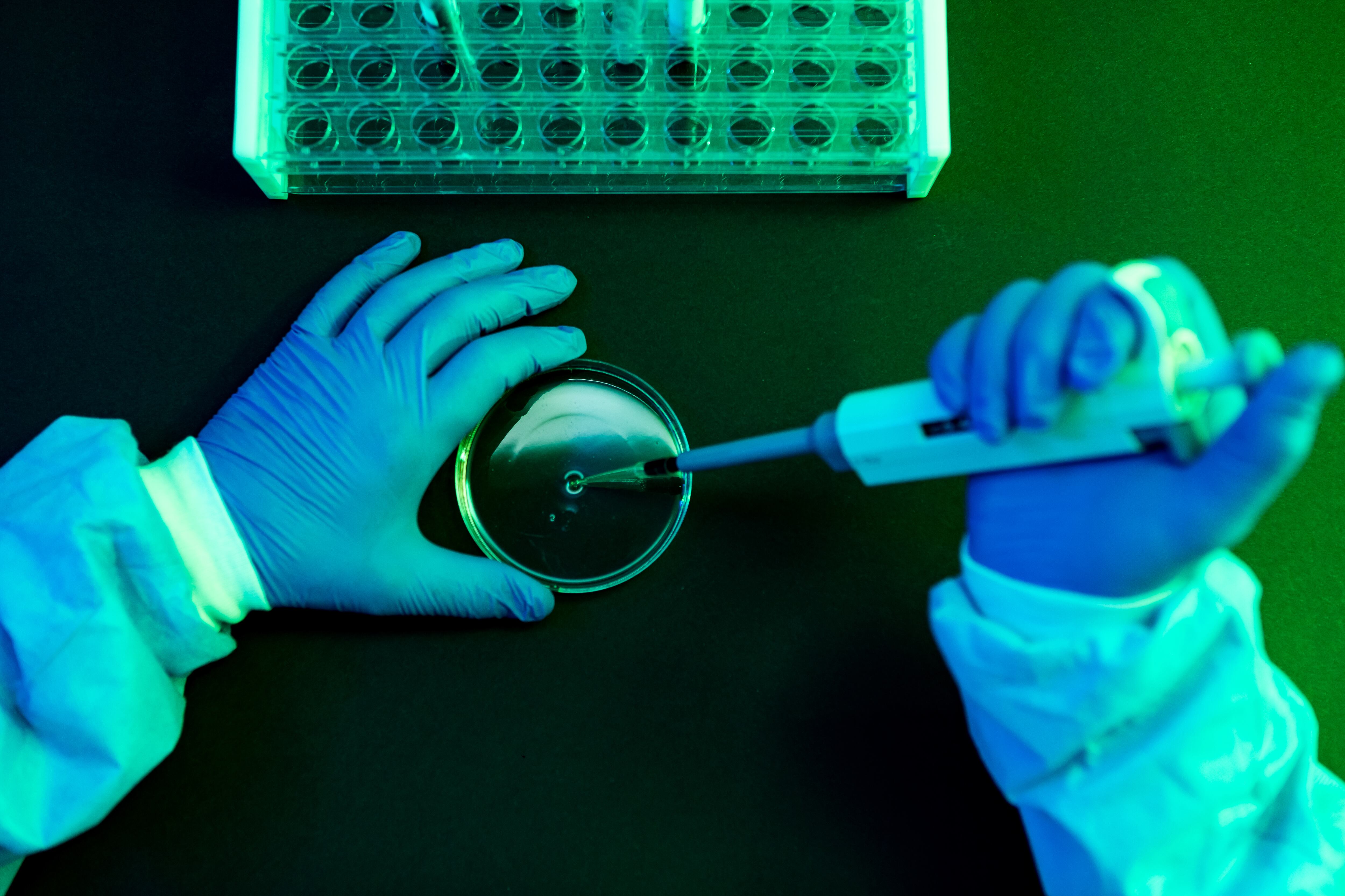 Aerial view of the hands of a scientist pouring fluid with the pipette into a petri dish in a laboratory with a green atmosphere. Photo: Getty Images