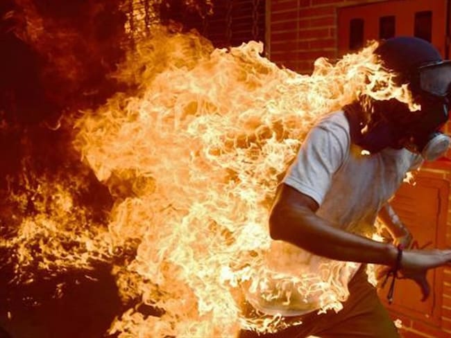 Ronaldo Schemidt fue nominado al World Press Photo de 2018 por el &quot;hombre en llamas&quot;