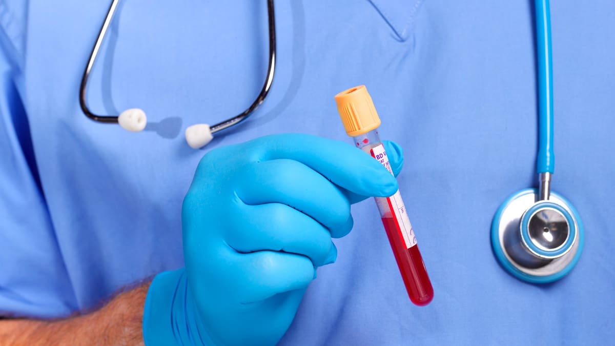 Preocupación en el Valle por interrupción de tratamientos en pacientes con VIH