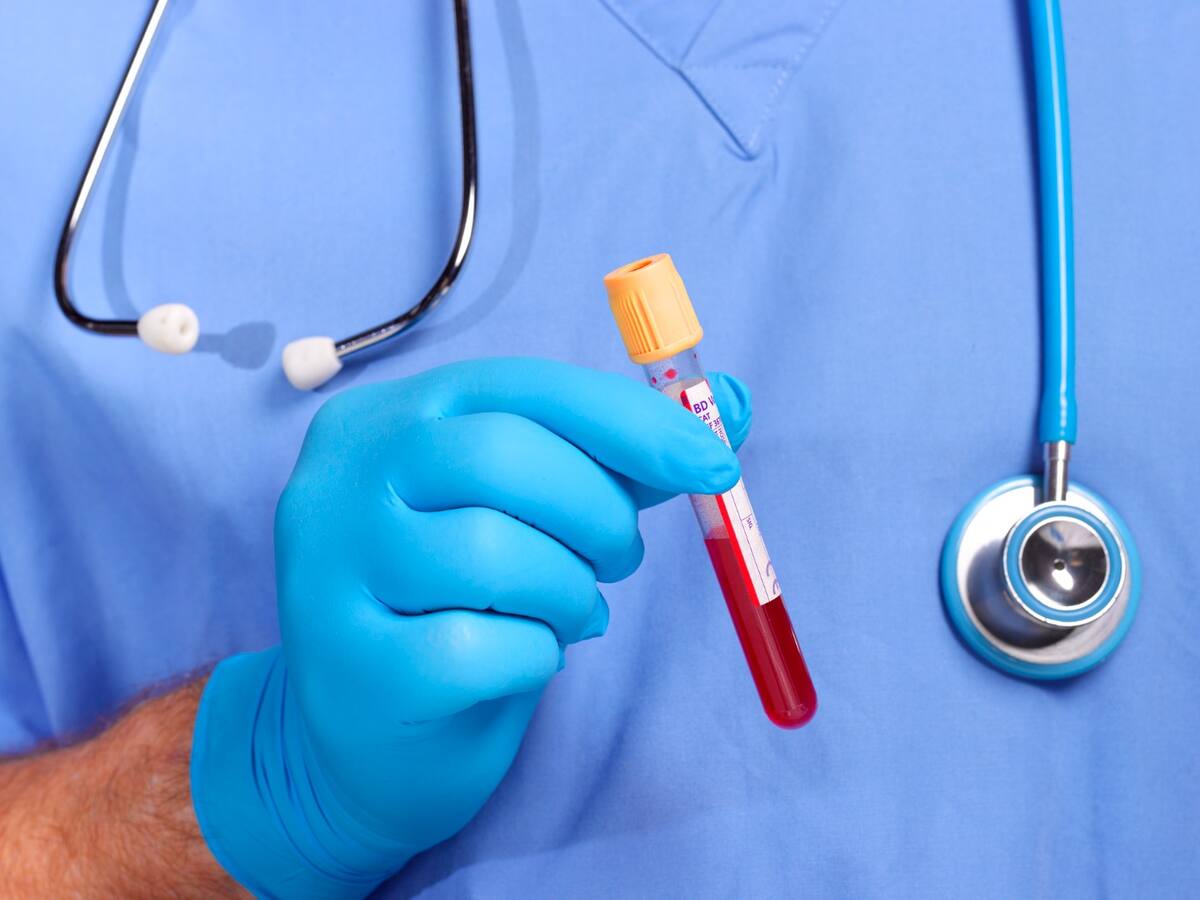 Córdoba reporta más de 600 casos de VIH/Sida en lo que va corrido del año 2024