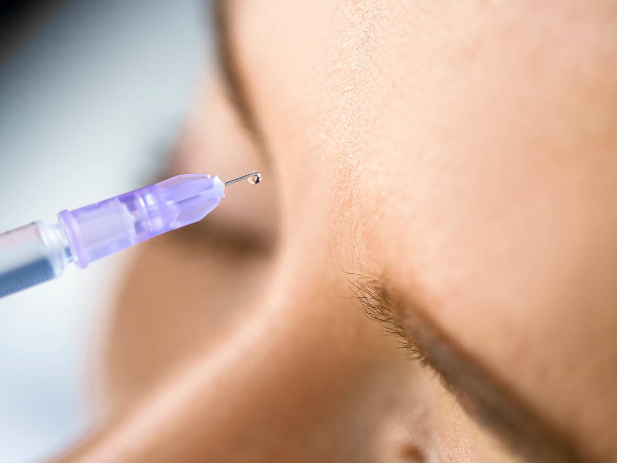 ¿En qué consiste la lipoescultura facial y qué riesgos hay de que deje cicatrices?