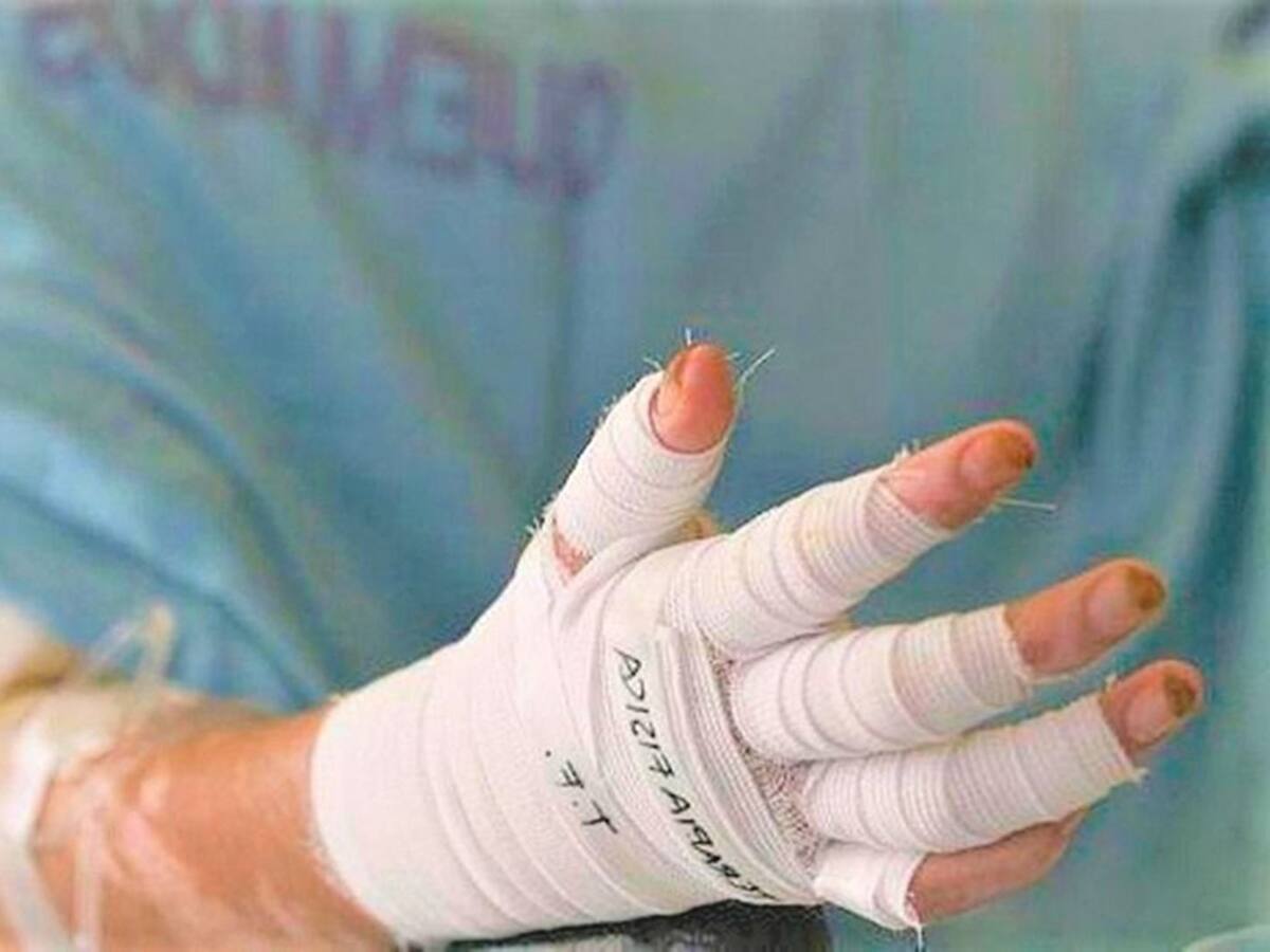 Fin de semana de velitas dejó alrededor de 333 lesionados, según informe INS