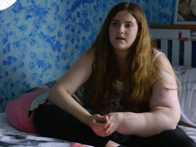 La niña con el trastorno genético que hace que su brazo izquierdo no pare de crecer. Foto: