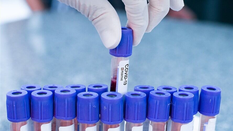 Imagen de referencia. Foto: Getty Images