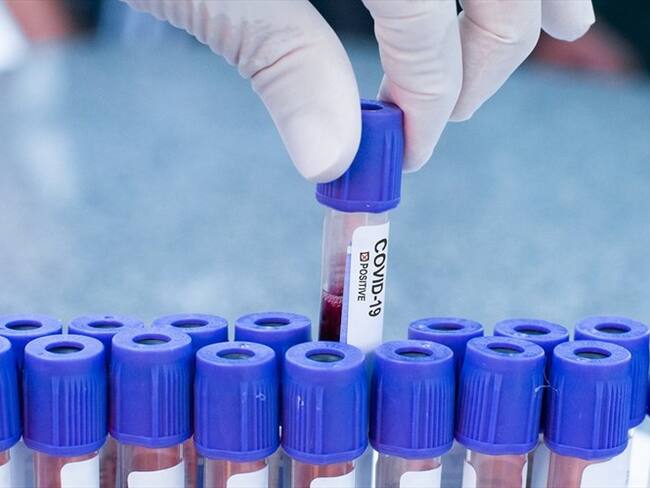 Imagen de referencia. Foto: Getty Images