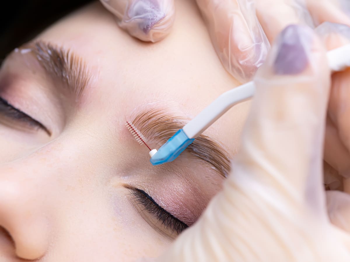 ¿El implante de cejas realmente sirve? Médica cirujana explicó sus beneficios