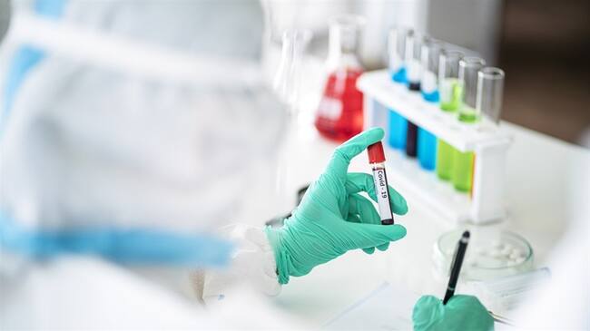 Casos de Coronavirus en Colombia. Foto: Getty Images