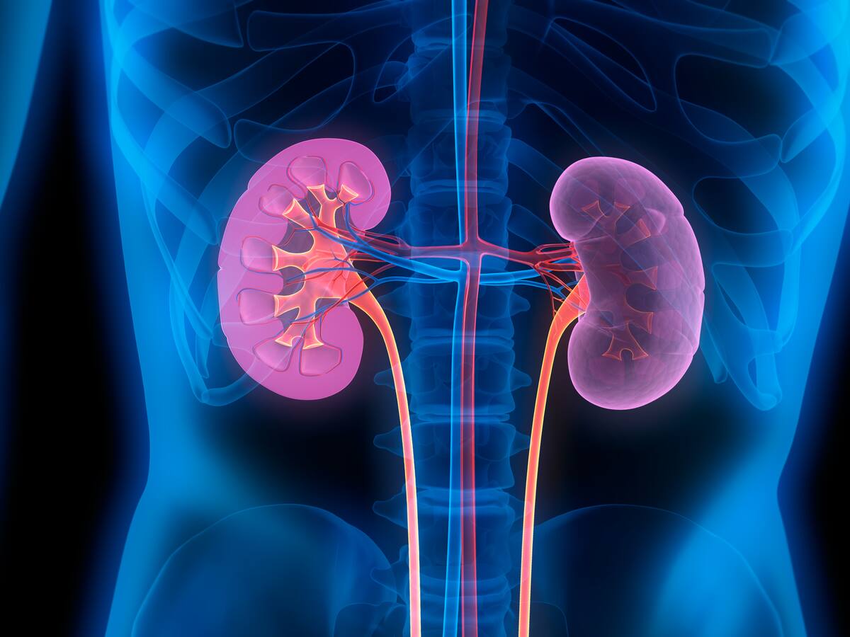 ¿Es mejor la diálisis o un trasplante de riñón? Cirujano explicó