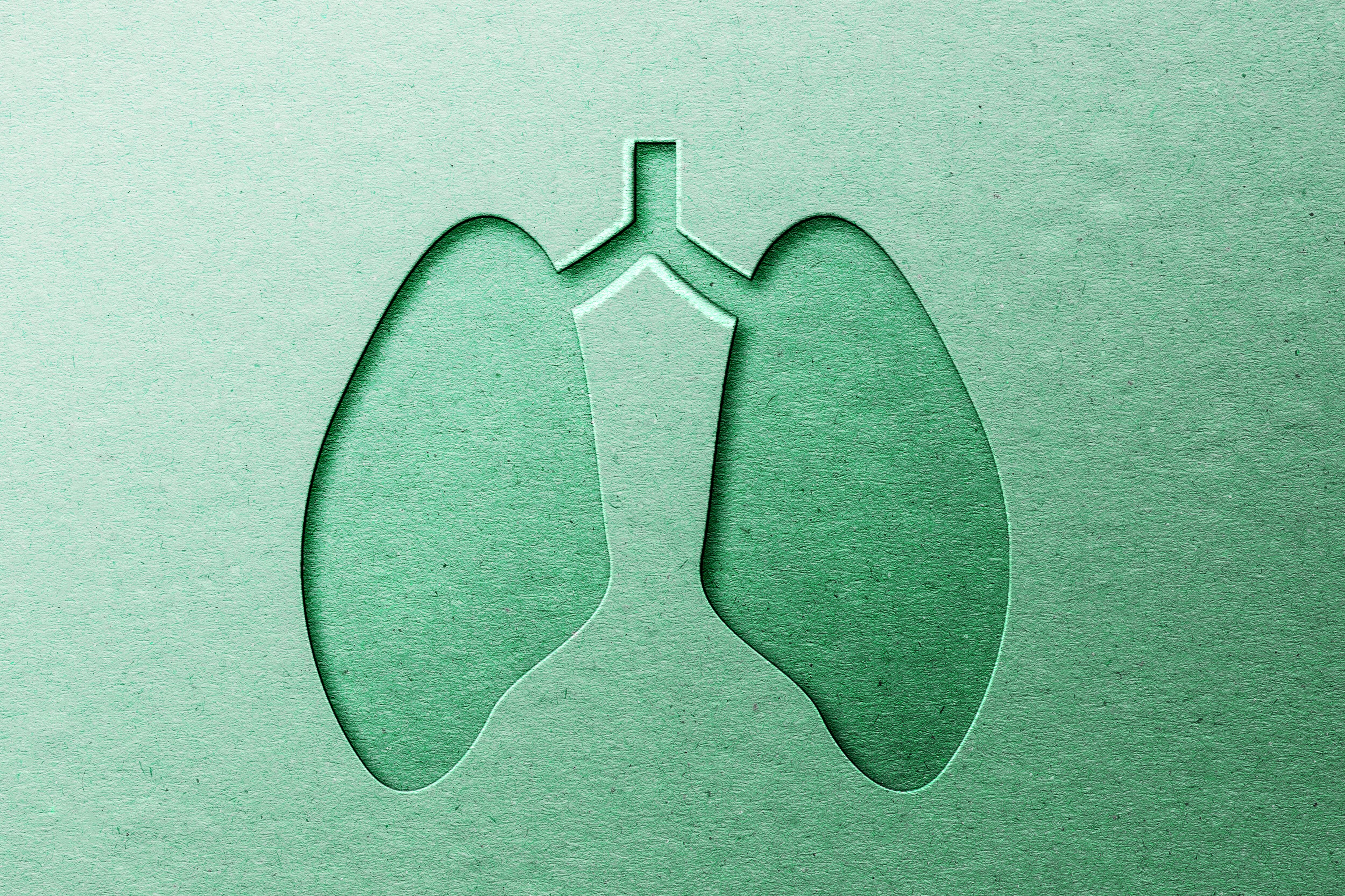 Imagen de referencia de Getty Images