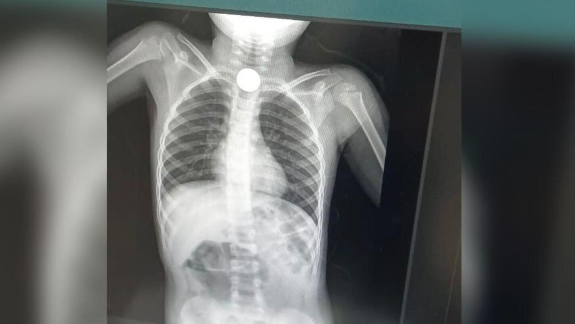 Placa del menor/ Jairo López 