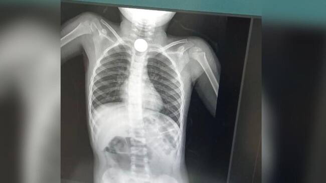 Placa del menor/ Jairo López