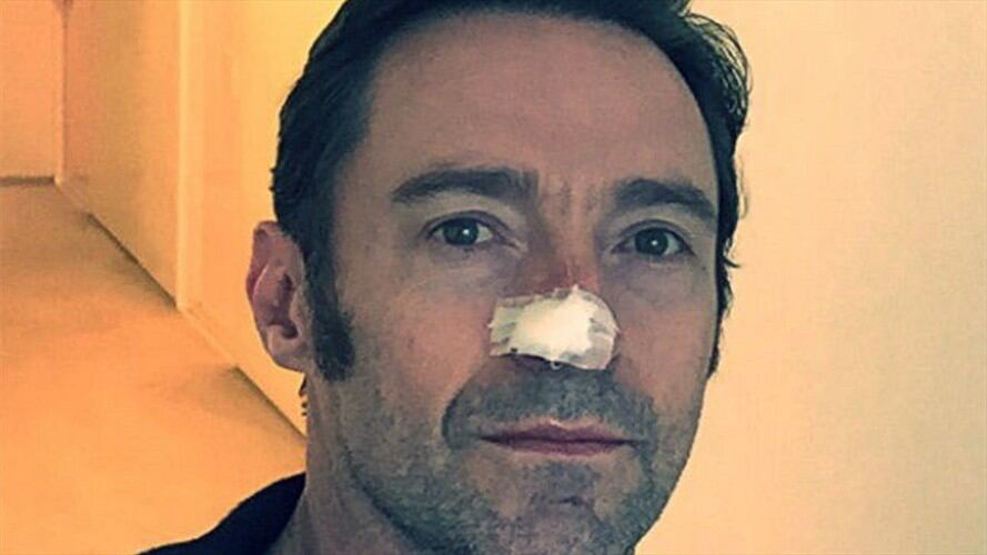 Hugh Jackman vuelve a ser operado a causa de un cáncer de piel. Foto: Bang Media