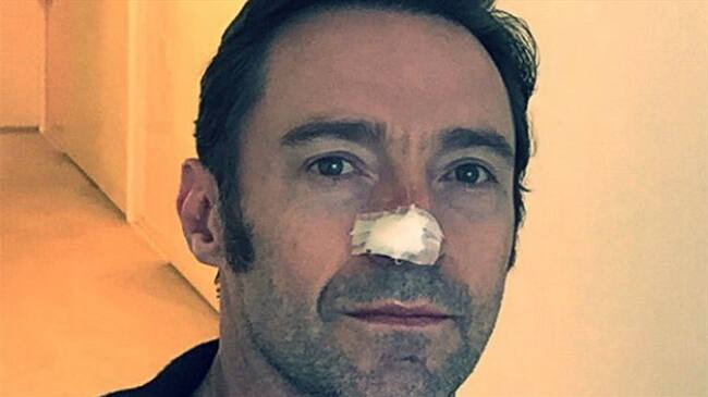 Hugh Jackman vuelve a ser operado a causa de un cáncer de piel. Foto: Bang Media