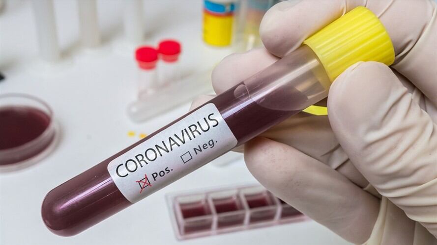 A través de su cuenta de Twitter, el secretario de Seguridad de Bogotá, Hugo Acero, confirmó que se contagió de COVID-19. Foto: Getty Images