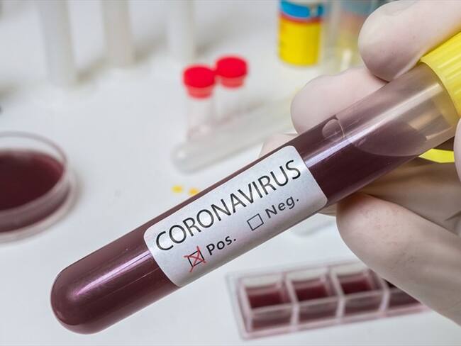 A través de su cuenta de Twitter, el secretario de Seguridad de Bogotá, Hugo Acero, confirmó que se contagió de COVID-19. Foto: Getty Images