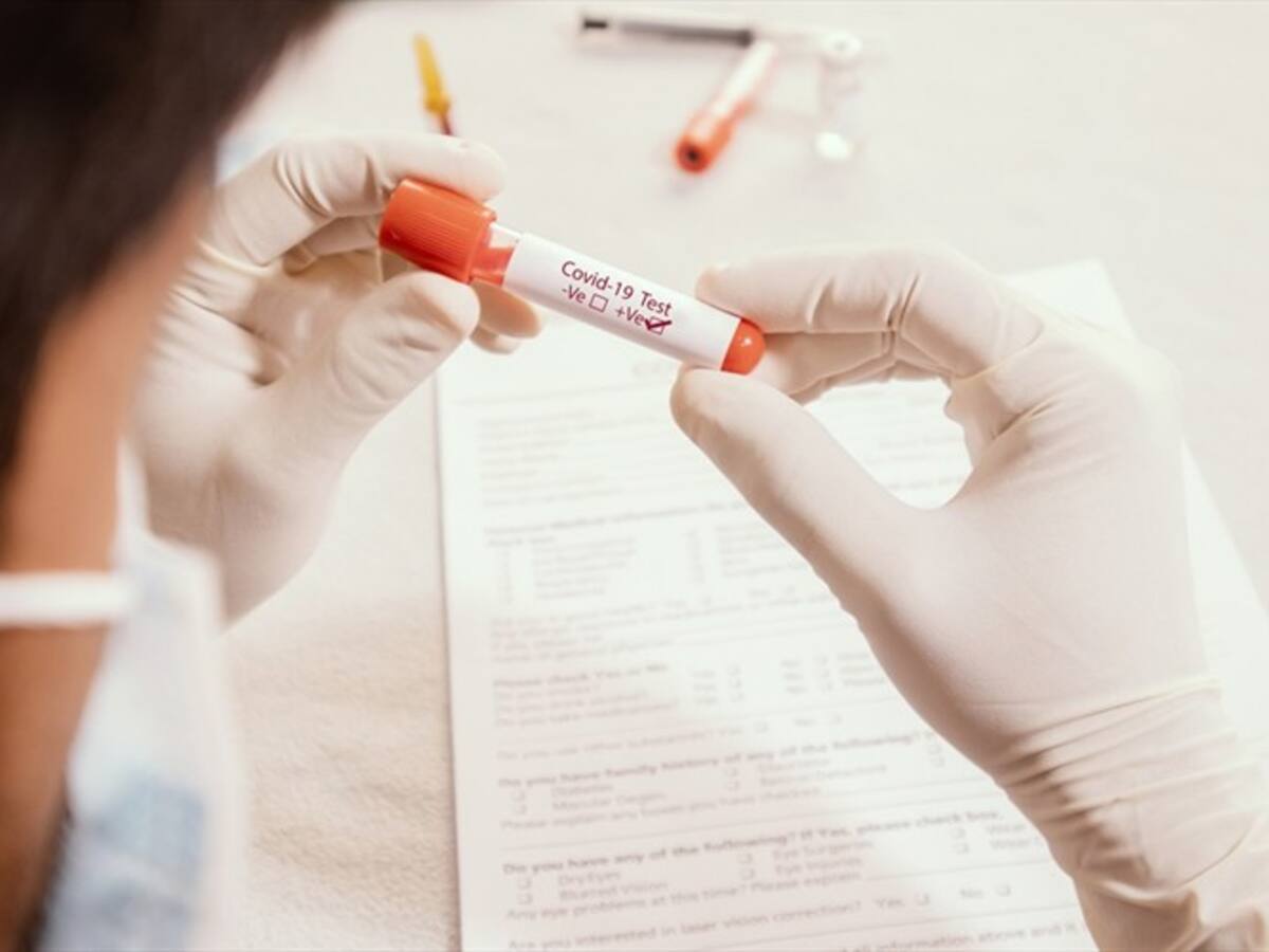 Las pruebas de COVID-19 no son de venta libre: Invima