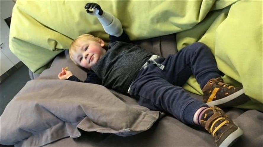 El padre que no paró hasta que logró diseñar e imprimir un brazo para su bebé. Foto: