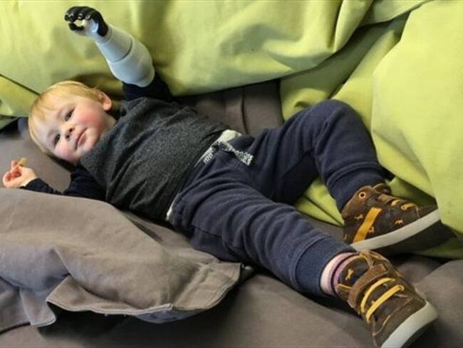 El padre que no paró hasta que logró diseñar e imprimir un brazo para su bebé. Foto: