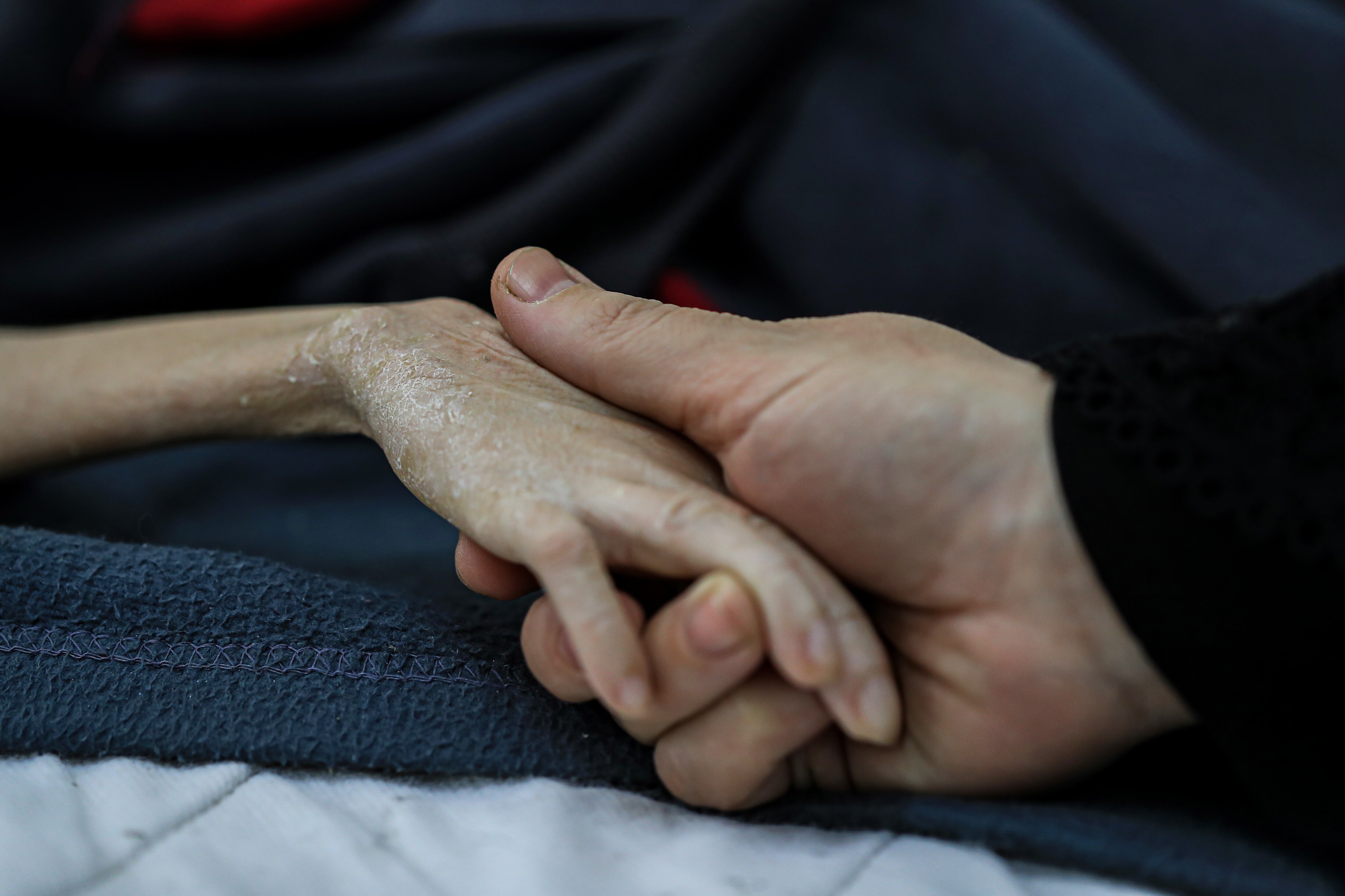 Referencia de malnutrición en Gaza. Foto: Jehad Alshrafi/Anadolu via Getty Images.