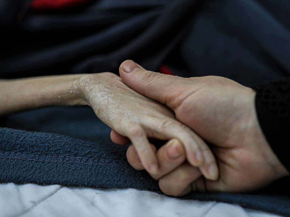 Unos 10.000 niños han sufrido malnutrición aguda en Gaza desde principios de 2025, dice ONU