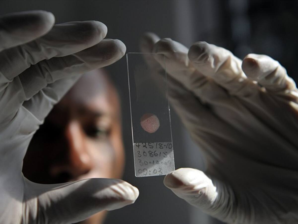 Autoridades sanitarias de Perú anunciaron que esperan eliminar la malaria en el año 2030