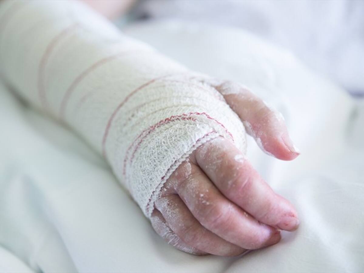 Dos niños resultaron quemados por incendio en el barrio La Pradera