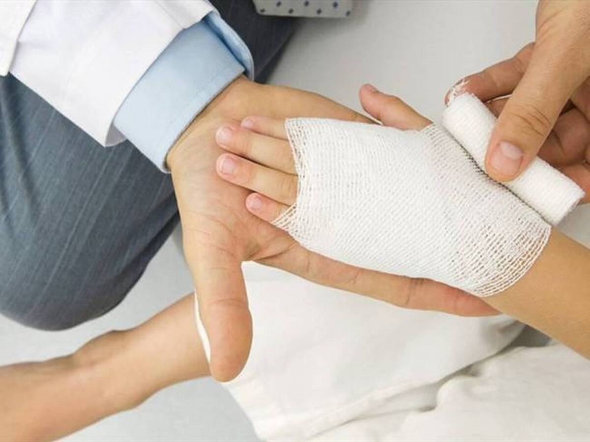 Ya son ocho casos de quemados por pólvora en inicio de año nuevo en Cartagena