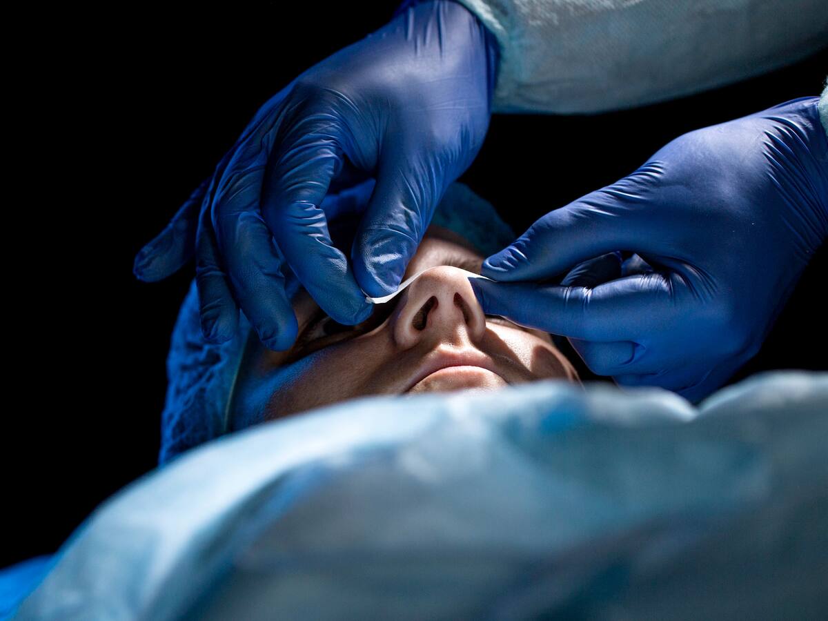Rinoplastia funcional y estética: ¿cómo es este procedimiento? Experto explica riesgos y beneficios