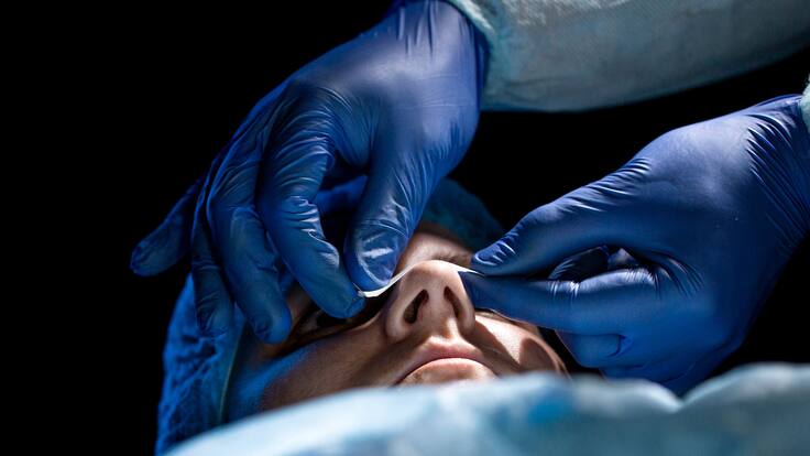 Rinoplastia funcional y estética: ¿cómo es este procedimiento? Experto explica riesgos y beneficios
