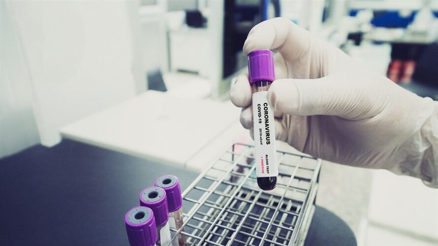 Leve aumento en los nuevos casos de COVID-19 en Colombia. Foto: Getty Images