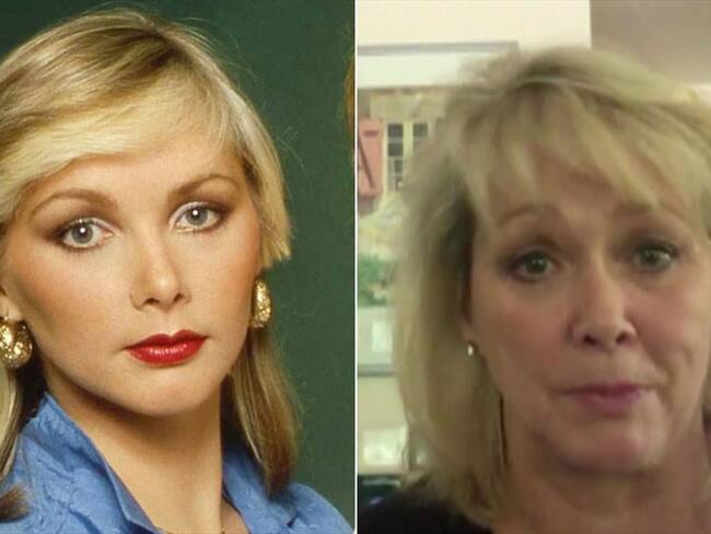 Cheryl Baker, que en 1980 perteneció al grupo Bucks Fizz, dice que sintió vergüenza cuando empezó a perder el cabello. Foto: Imagen tomada de BBC Mundo.