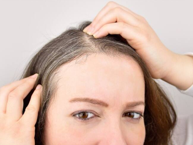 ¿A usted qué le saca canas?. Foto: Getty Images