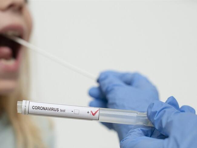 Pruebas PCR contra COVID-19. Foto: Getty Images / Paul Biris