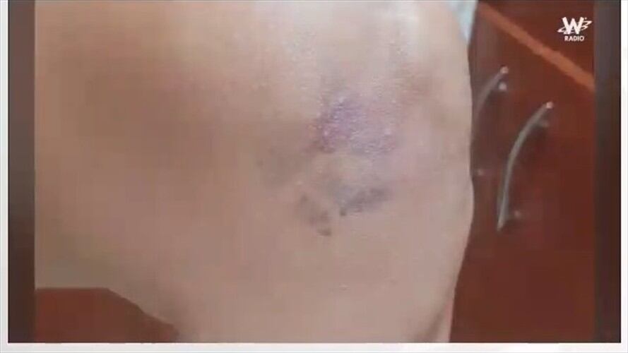 Fotografías comprobarían maltrato a la Teniente de la Policía que denunció abuso sexual.