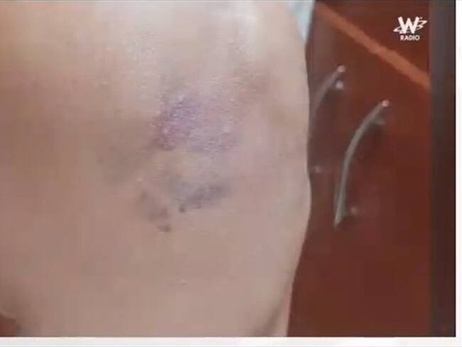 Fotografías comprobarían maltrato a la Teniente de la Policía que denunció abuso sexual.