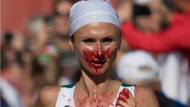 Volha Mazuronak con la cara ensangrentada en la maratón de Berlín. Foto: Associated Press - AP