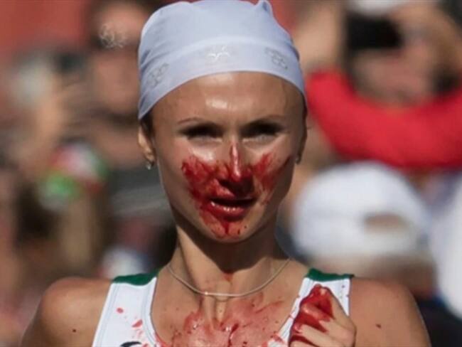 Volha Mazuronak con la cara ensangrentada en la maratón de Berlín. Foto: Associated Press - AP