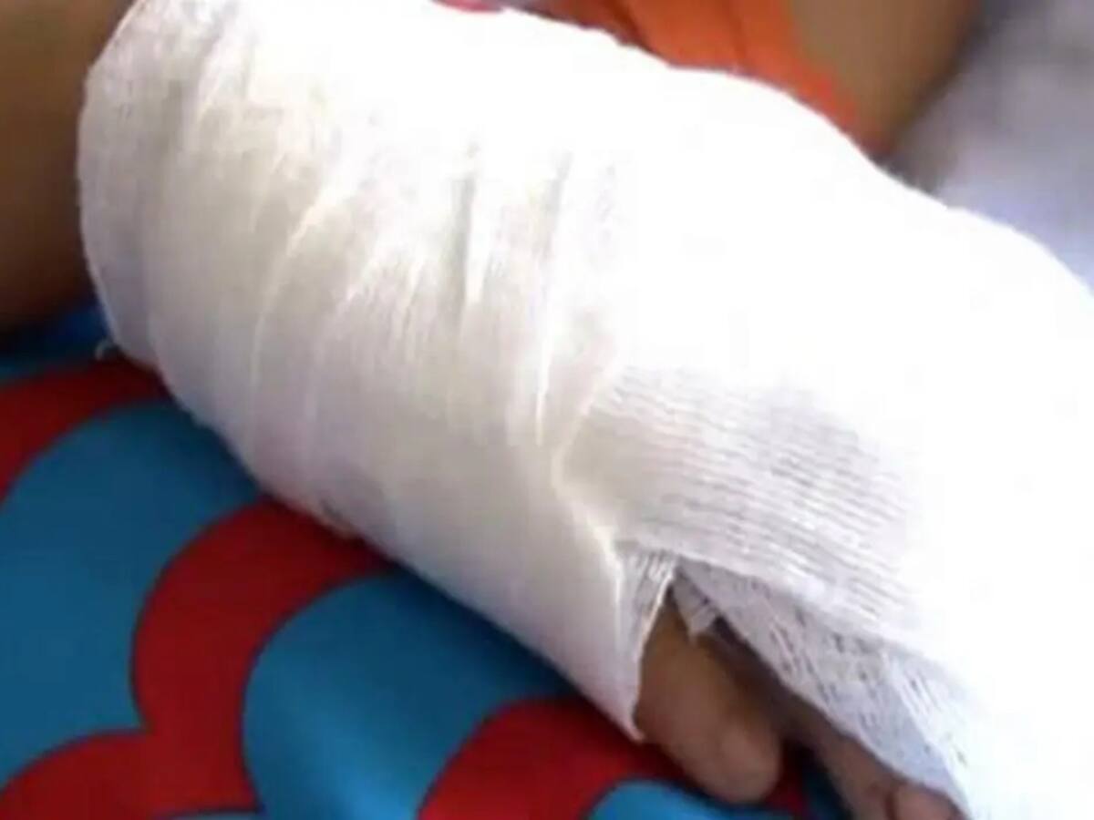 Un menor indígena entre las nuevas víctimas de la pólvora en Risaralda