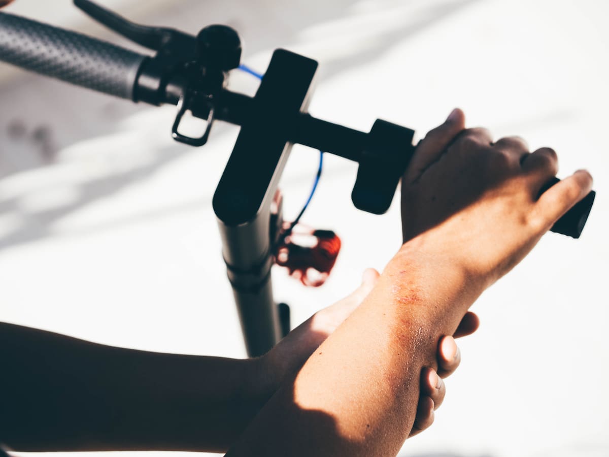 Autoridades buscan a hombre que atropelló a menor de edad con patineta eléctrica en el norte de Bogotá