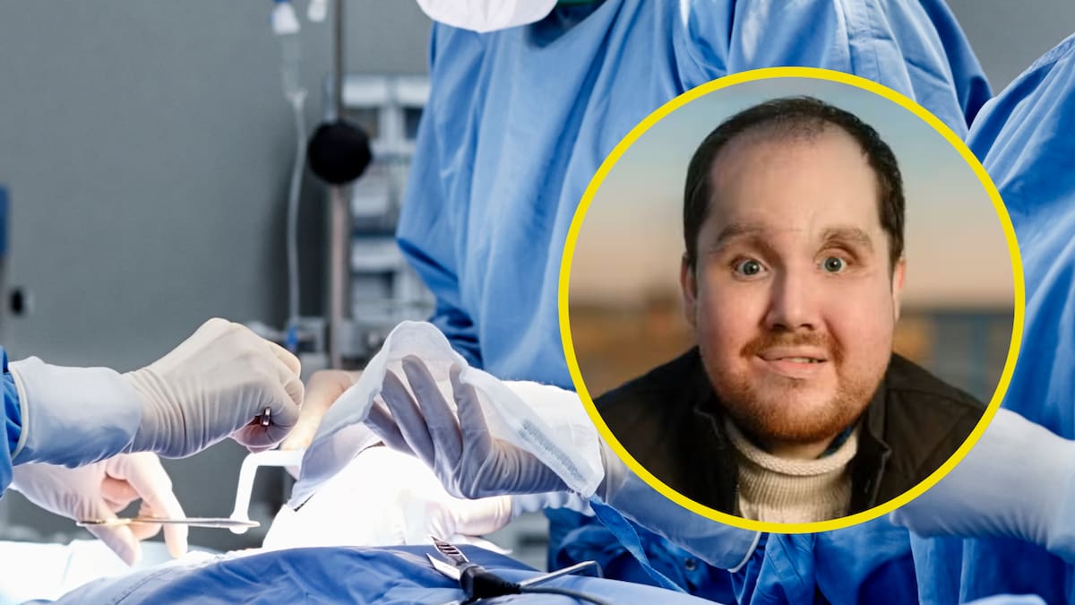 Clínica Mayo logró exitoso trasplante facial: ¿Cómo fue este procedimiento? Doctor explica