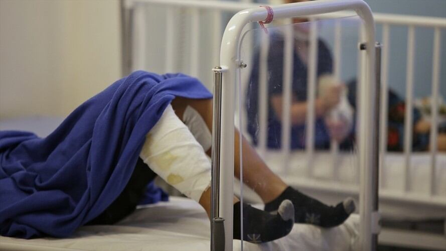 Joven de 16 años de quemó los genitales. Foto: Colprensa