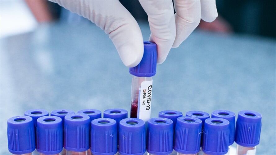 Casos de Coronavirus en Colombia siguen a la baja. Foto: Getty Images