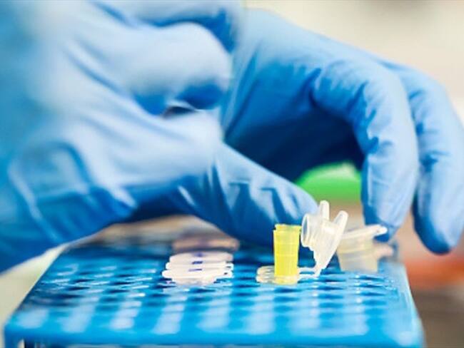Científicos de Instituto Pasteur afirman que encontraron vía para eliminar células con VIH