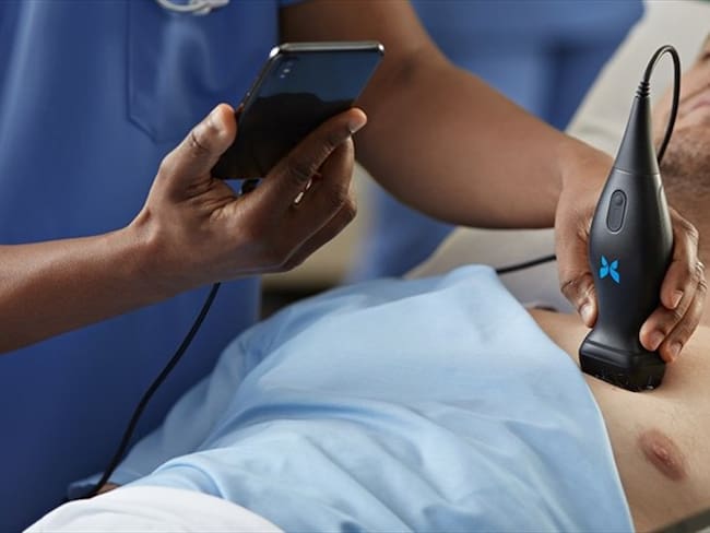 El aparato que le permite hacerse una ecografía desde su celular. Foto: Cortesía