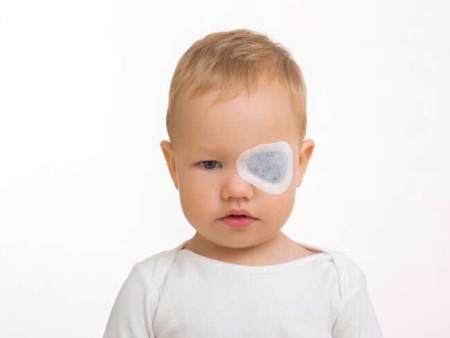 Ojo perezoso: ¿A qué edad debe ser tratado?, oftalmólogo explicó