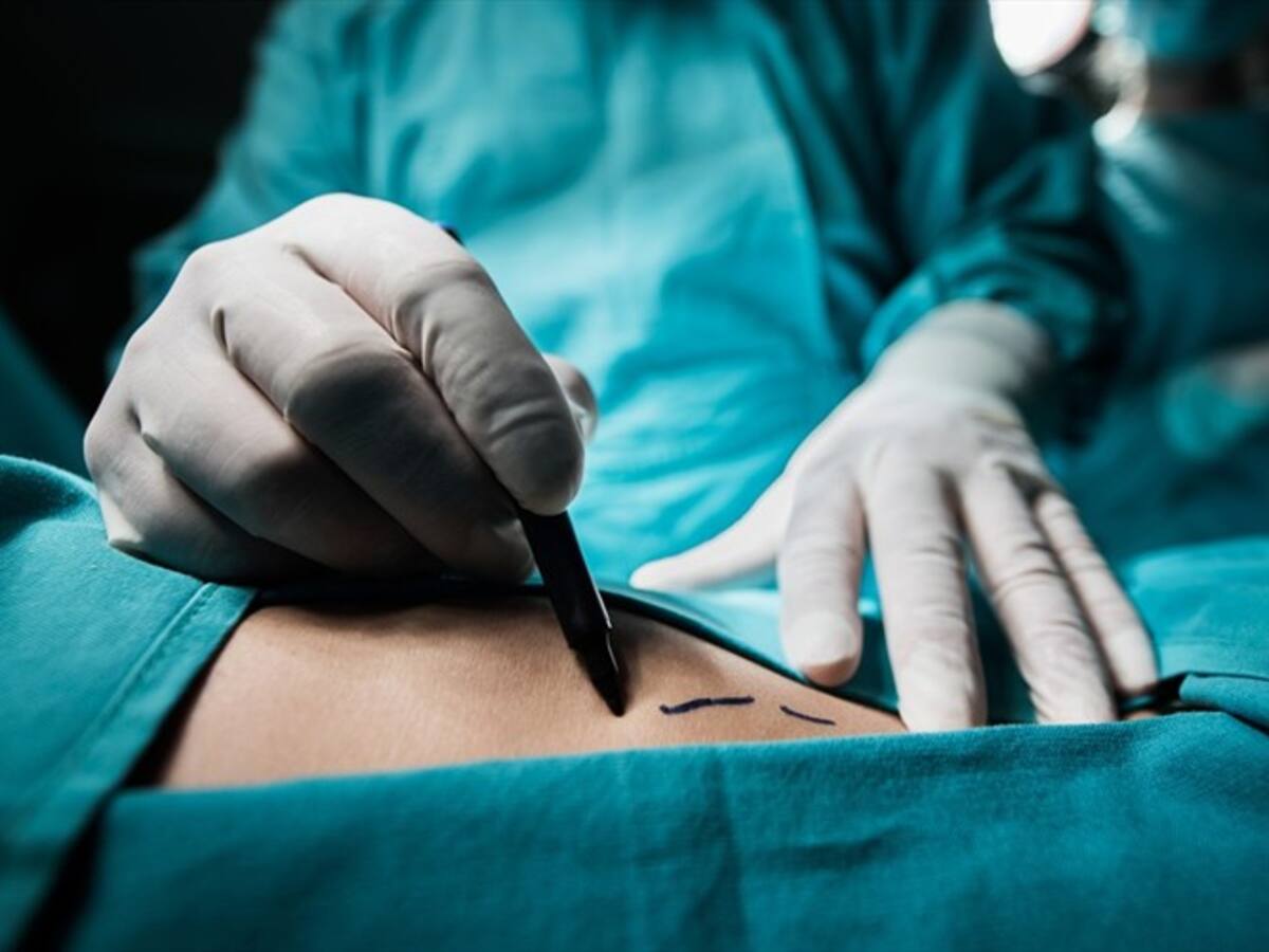 Más mujeres denuncian al Cirujano Yesid Martinez