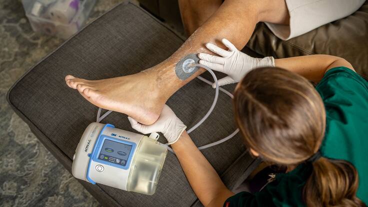 Terapia de presión negativa: ¿Cómo funciona para la curación de heridas y cicatrices? Explicación