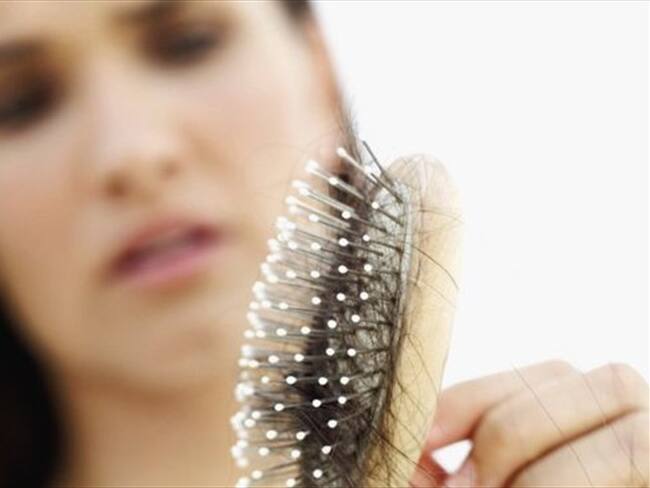 De acuerdo con expertos, los cabellos en el cepillo no son un motivo para alarmarse. Foto: THINKSTOCK